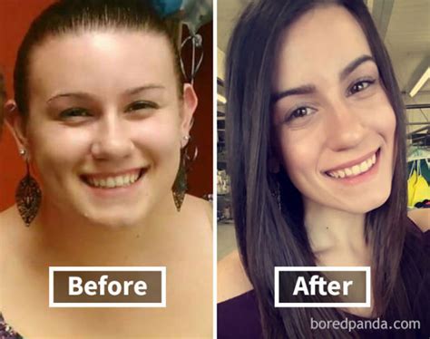 Heres How Weight Loss Can Change Your Face 40 Pics