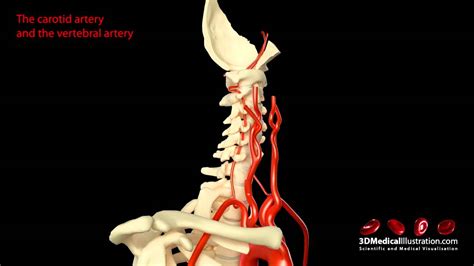 This artery courses upward and to the back and supplies structures in the face and neck, including the teeth and gums, thyroid given its essential role in supplying the head and neck, disorders of or damage to the common carotid arteries can have a serious clinical impact. Arteries of the neck - YouTube