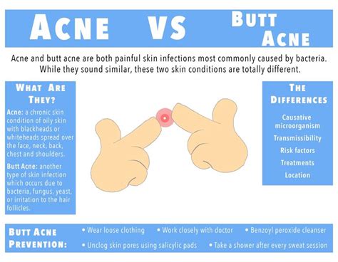 What Is Butt Acne Treatment Options And Causes Of Butt Acne