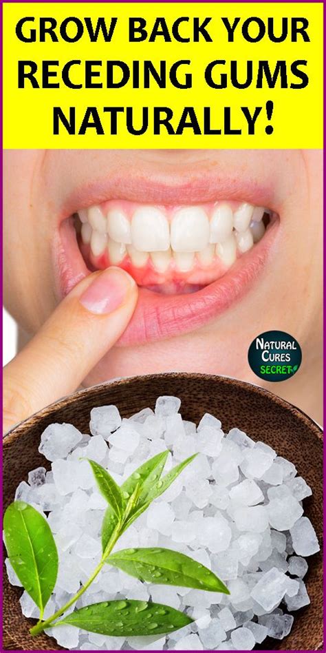 Pin On Dental Care Oral Hygiene