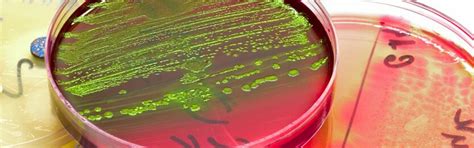 Listeria Monocytogenes Telling Volgens Infoblad 85 Eurofins