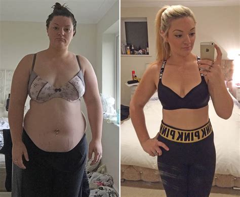 Woman Sheds 14st And Splashes £12k On Surgery You Wont Believe What She Looks Like Now