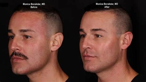 How To Get A Slimmer Face For Guys The Magnum Guide Magnum Workshop