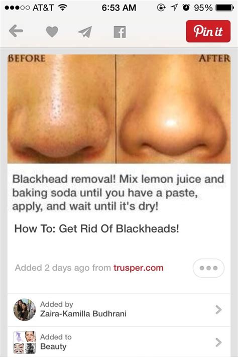 Blackhead Removal Recipe Fashion Beauty Trusper Tip Body Health Health And Nutrition Diy