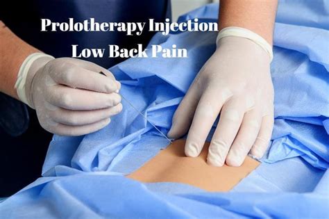 Prolotherapy Injections For Chronic Low Back Pain Dr Vikram Rajguru