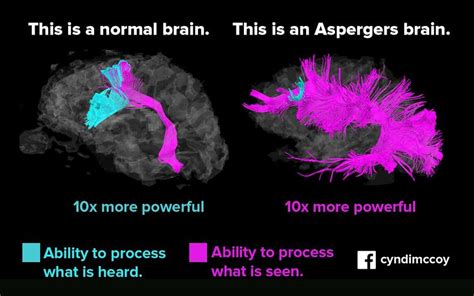 What Are The Differences In The Brains Of People With Aspergers