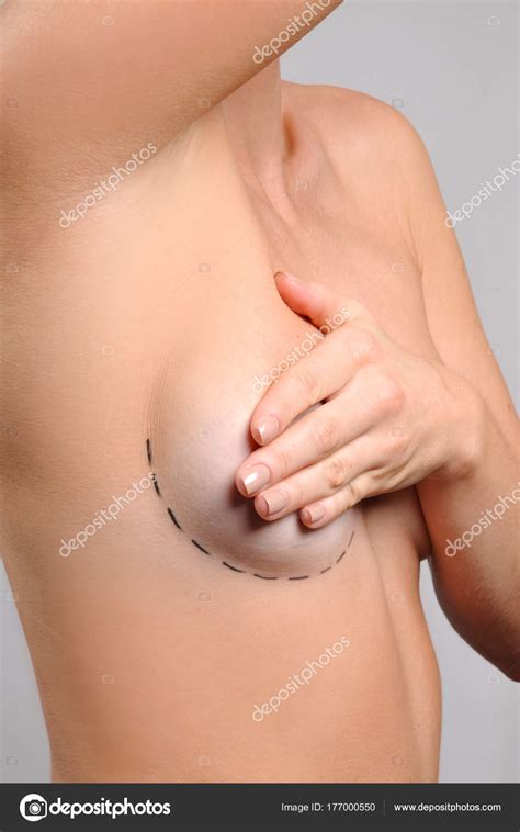 Breast Enlarge Surgery Nude Pics Telegraph