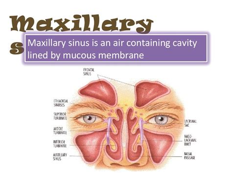 Radiology Of Maxillary Sinus