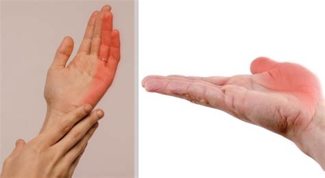 The 7 Most Frequent Causes Of Numbness In The Hands Which Should Never