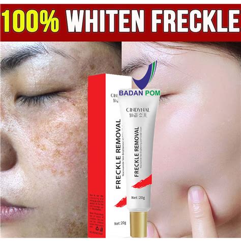 Jual Bpom Cindynal Whitening Freckle Cream Remove Dark Spots Anti Penuaan Dini Penghilang Flek