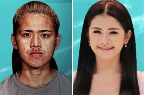 Worlds Most Extreme Tv Show See Jaw Dropping Surgery Transformations