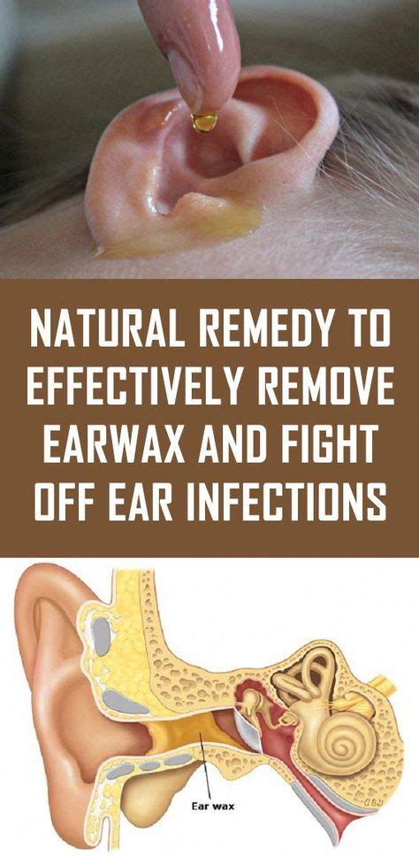 See Your Earwax And Youll See How Healthy You Are Ear Infection