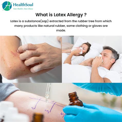 Latex Allergy Symptoms And Management Allergyimmunology Healthsoul