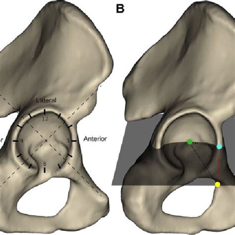 A The Position Of The Acetabulum Was Described Using A Clock Face Download Scientific