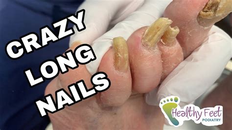 Crazy Long Thick Nails Youtube