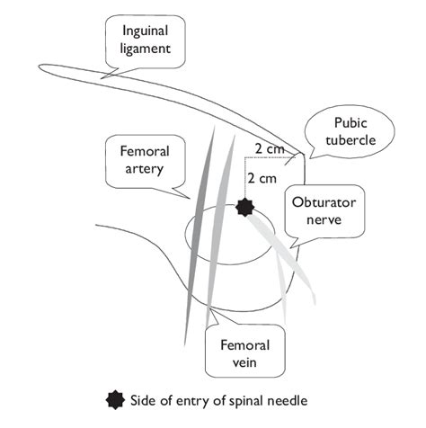 The Anatomy Of The Obturator Nerve As It Emerges Through The Obturator