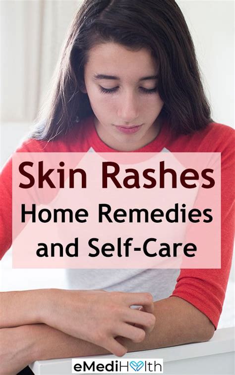 Itching Skin Remedies Natural Rash Remedies Skin Rash Remedies Heat Rash Remedy Home