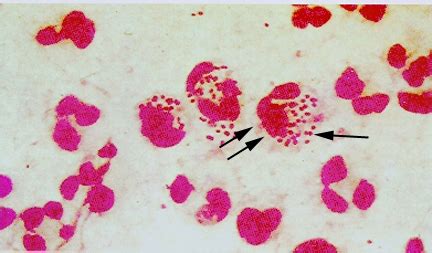 Гонококки располагаются. Гонококки диплококки. Гонококки диплококки. Нейссерия гонорея микроскопия. Гонорея диплококк микробиология.