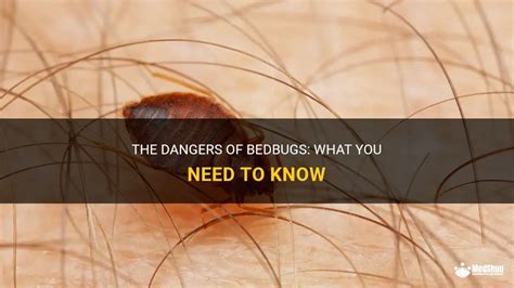 The Dangers Of Bedbugs What You Need To Know MedShun