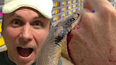 Snake Bite Challenge King Kobra Win Youtube