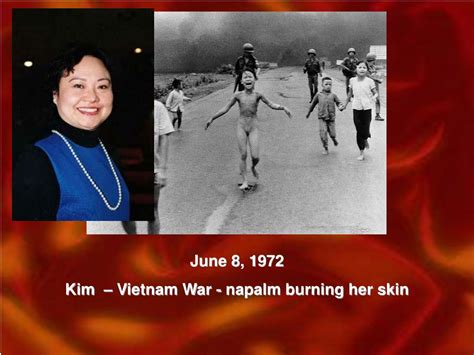 Ppt June 8 1972 Kim Vietnam War Napalm Burning Her Skin