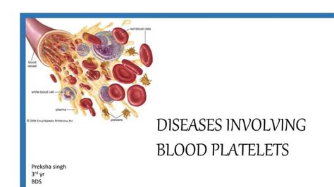 Diseases Of Platelets Ppt