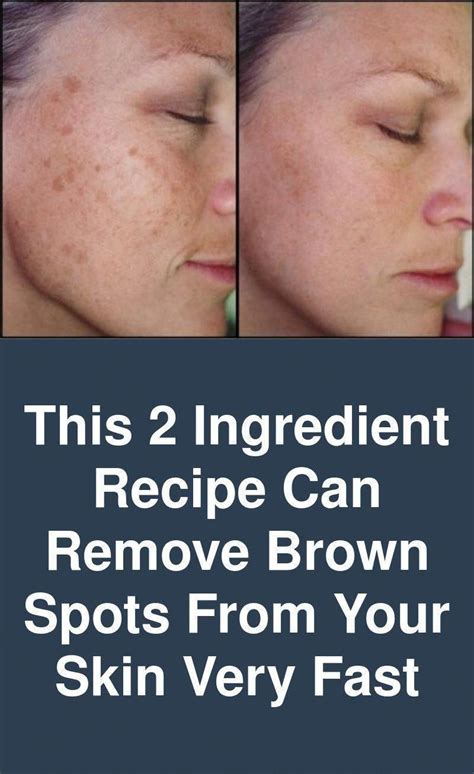 The Best Way To Get Rid Of Brown Spots On Face Removebrownspotsonface