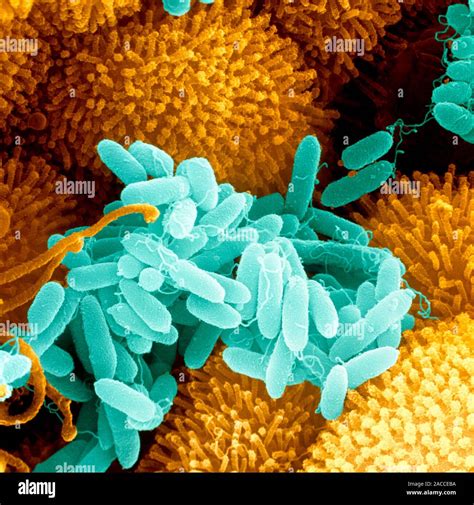 La Bacteria Pseudomonas Aeruginosa Color Análisis Micrografía De