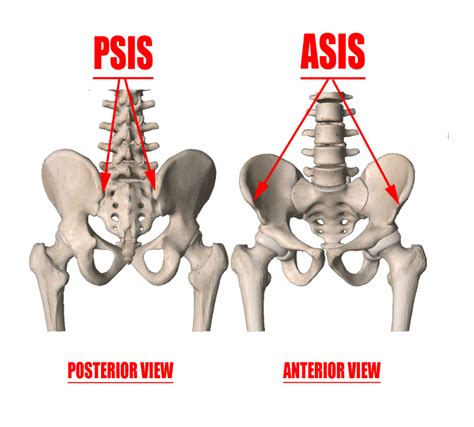Psis Sacroiliac Joint Pain And Dysfunction Acusport Education The