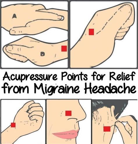 Acupressure Points For Relief From Migraine Headache Migraineremedies Naturalmigrainerelief