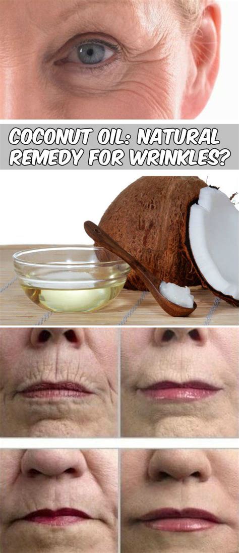 Coconut Oil Is Good For Wrinkles We Love Beauty Beauty Treatments