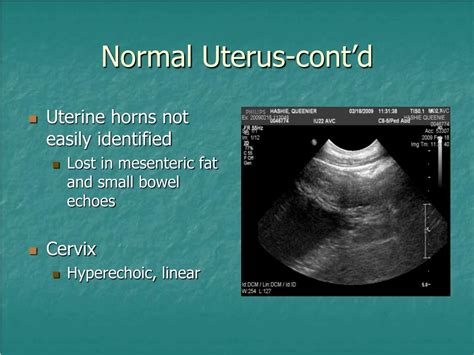 Ppt Ultrasound Of The Reproductive System Stacy Fielding Powerpoint