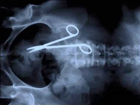 Funny X Ray Images That Seem Too Ridiculous To Be Real