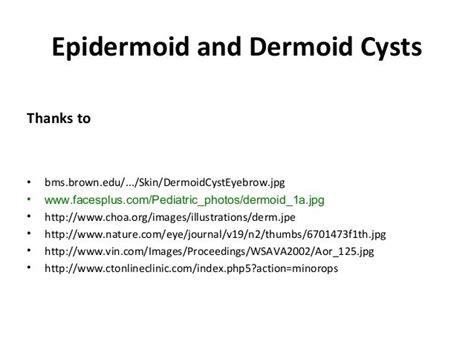 Dermoid And Epidermoid Cysts