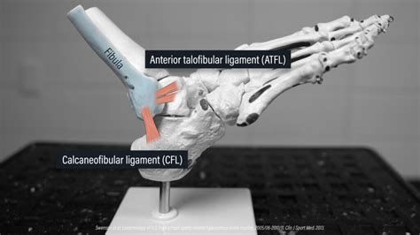 Lateral Ankle Sprain Rehab E3 Rehab