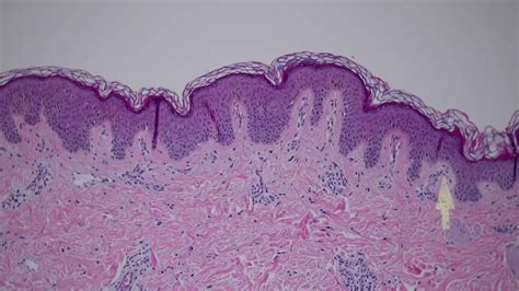 Normal Skin Histology Explained By A Dermatopathologist Normal Skin