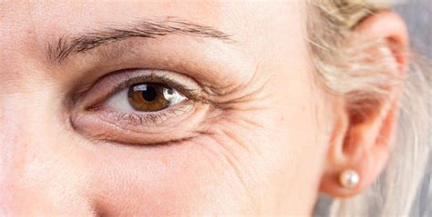 Skin Aging What Are 12 Most Common Signs Of Aging Skin