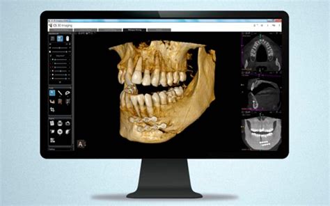 ¿qué Tecnología En Radiología Digital Debe Tener Una Clínica Dental