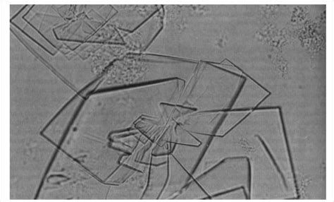 El fosfato de calcio es insoluble en agua, pero soluble en ácidos: Calciu Blog: Fosfato De Calcio O Que E