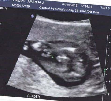 30 Weeks Pregnant Ultrasound Gender