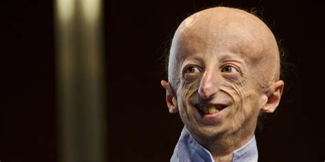 For Kids With Progeria New Therapies May Offer Revolutionary Hope For