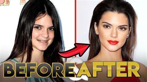 Kendall Jenner Glow Up 2019 Before And After Transformations Kuwtk