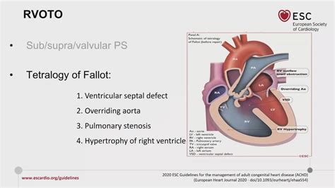 Esc 365 Right Ventricular Outflow Tract Obstruction And Tetralogy Of