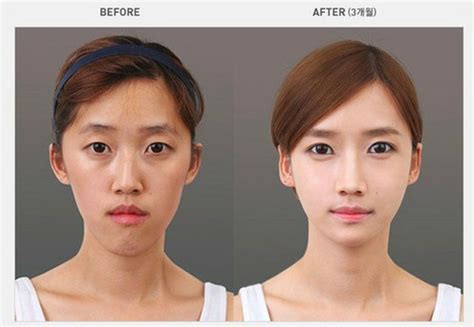 The Power Of Makeup Shocking Photos Ulzzang Before After