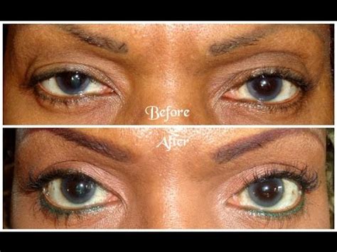 She became friends with the jenners around the age of 11. Part 1: Hooded Eyelid Surgery | Blepharoplasty | Cost ...