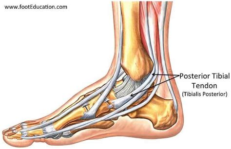 Tibialis Posterior Tendinopathy Pain Around Inside Ankle Bone Fit