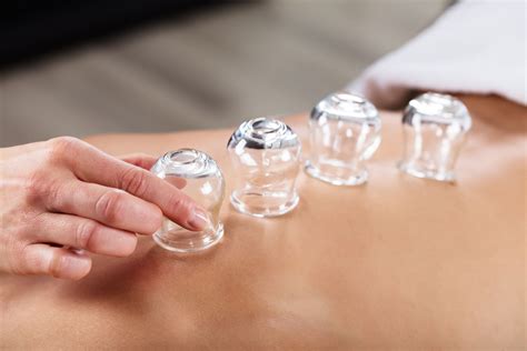 The Benefits Of Cupping Massage Active Approach Health And Wellness