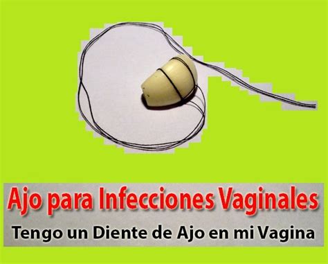 Infecciones Vaginales Por Hongos En Genitales Femeninos Causas Síntomas