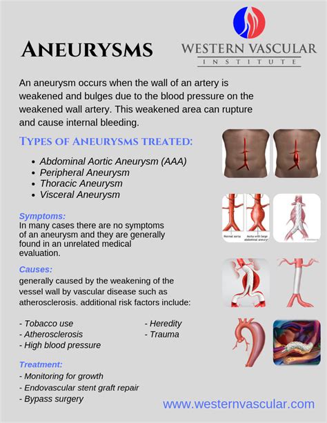 Aneurysms Western Vascular Institute