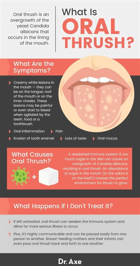 Oral Thrush Symptoms Causes Treatment Prevention Dr Axe
